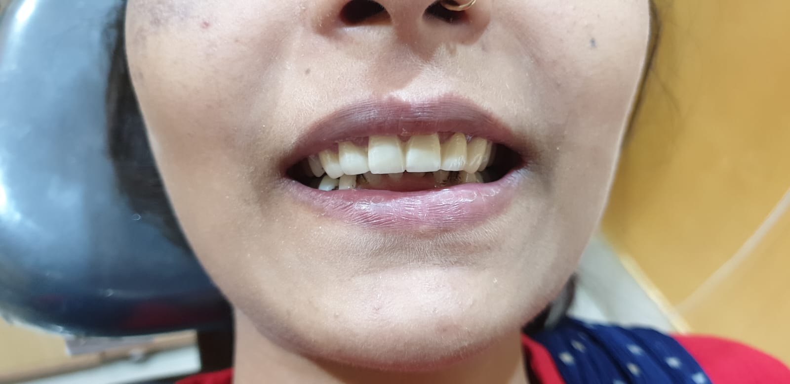 AFTER SMILE DESIGN